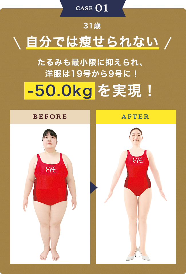 自分では痩せられない たるみも最小限に抑えられ、洋服は19号から9号に！-50.0kg を実現！
